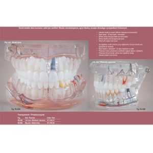 Real Series Model stomatologiczny zgryz idealny z przypadkami klinicznymi przeźroczysty wielkość naturalna