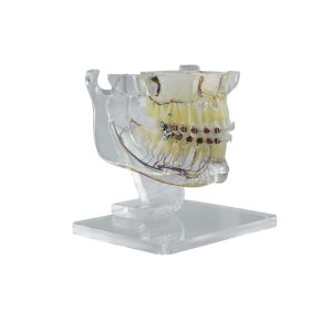 Real Series Model ortodontyczny z metalowymi i ceramicznymi zamkami (na biurko) fig 2