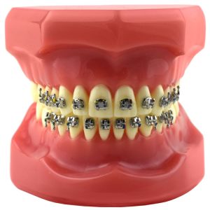 Model pokazowy z zamkami Mark-II Roth .022" 5x5, z haczykiem na 3,4,5