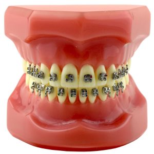 Model pokazowy z zamkami Mark-I Roth .022" 5x5, z haczykiem na 3,4,5