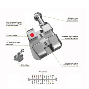 Zestaw zamków Diamond Star Roth .022" 5x5, z haczykiem na 3,4,5 (20 szt.)